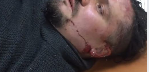 Полиция проверяет информацию об избиении автивиста в Запорожье 
