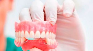 протезирование зубов Запорожье