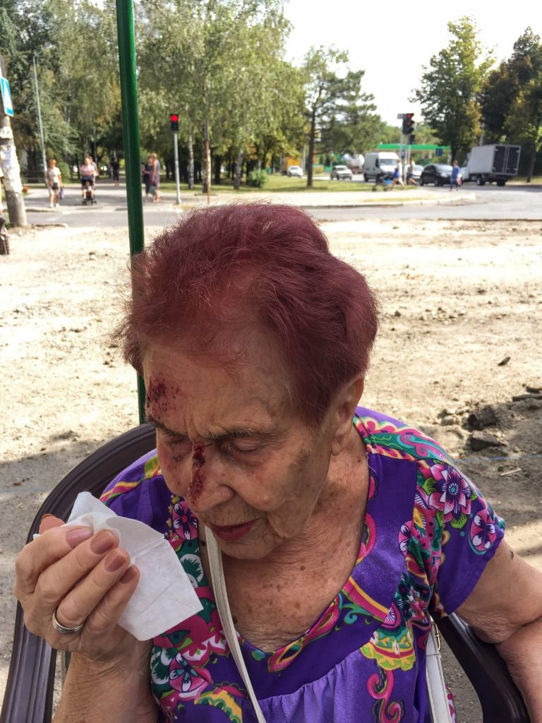 В Запорожье женщина упала на участке, где проводят ремонт