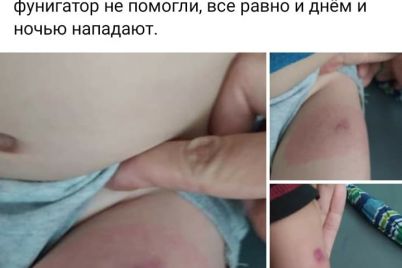 noga-raspuhla-v-dva-raza-stala-krasnaya-i-tverdaya-na-zaporozhskom-kurorte-otdyhayushhih-atakuyut-komary-i-dnem-i-nochyu-foto.jpg