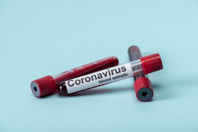 u-treh-zhitelej-energodara-obnaruzhili-koronavirus-dvoe-iz-nih-deti.jpg