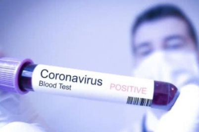 v-oblasnomu-moz-rozpovili-pro-stan-rozpovsyudzhennya-koronavirusu-u-zaporizkij-oblasti.jpg