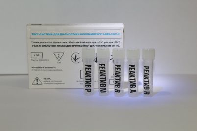 v-ukrad197ni-rozrobili-test-yakij-viznachad194-vodnochas-koronavirus-i-dva-shtami-gripu.jpg