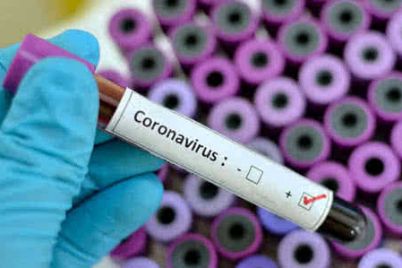 v-ukrad197ni-zafiksuvali-pershij-vipadok-zahvoryuvannya-na-koronavirus.jpg
