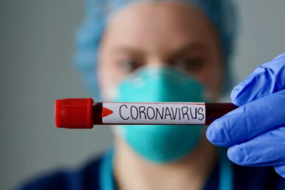 v-zaporozhskoj-oblasti-koronavirusom-zabolelo-80-chelovek.png