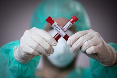 zaporozhskij-oblastnoj-czentr-moz-prekrashhaet-provodit-platnoe-testirovanie-na-koronavirus.jpg